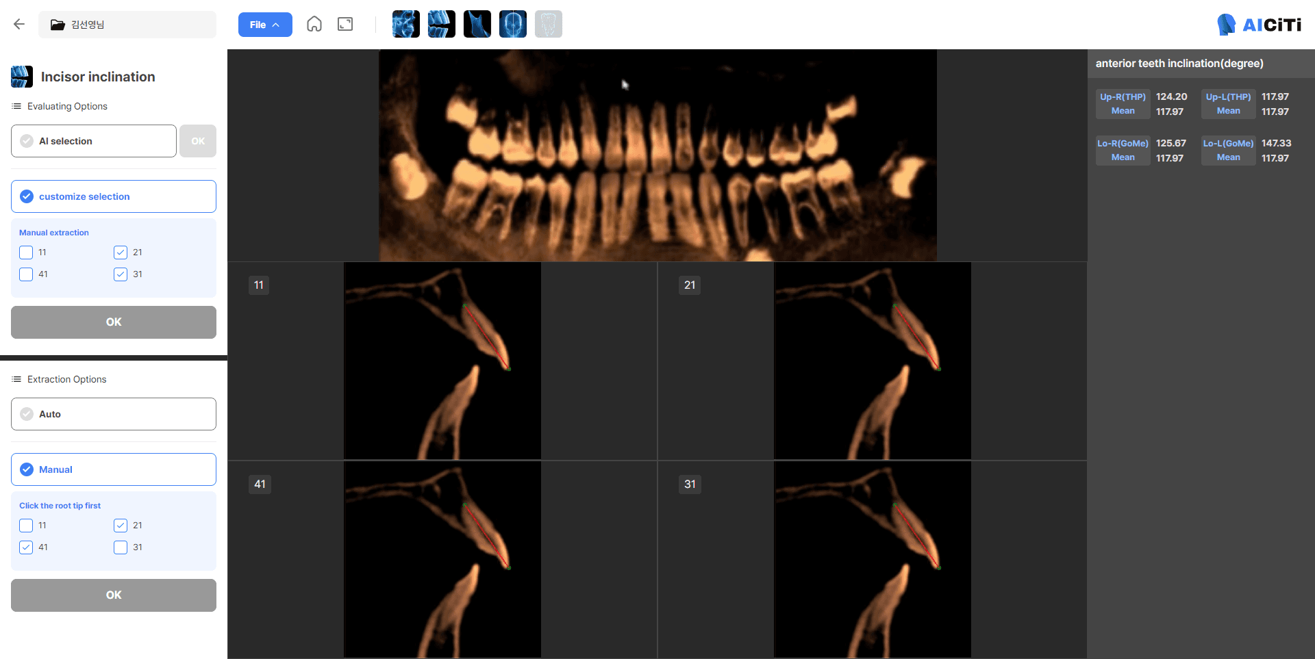 AI-powered 3D Oral Data Analysis