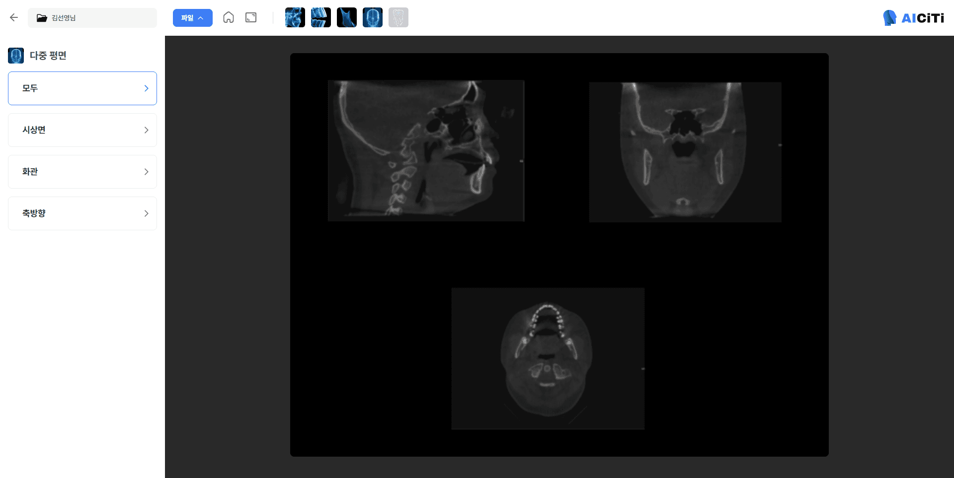 Medical-grade 3D Visualization